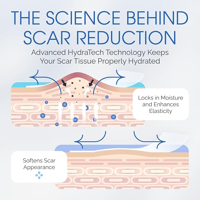 Medical Grade Silicone Scar Sheets - Large 7" Water Resistant, Reusable Silicone Scar Strips - Breathable Clear Scar Tape for C-Section, Tummy Tuck, Surgical Scars Keloids, etc. - 4 Strips