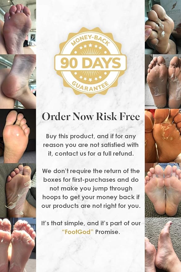 FootGod Exfoliating Foot Peel: Reveal Baby Smooth Feet, Moisturizing Aloe Gently Helps Peel Dead Skin, Eliminate Calluses with Luxury Skincare Technology