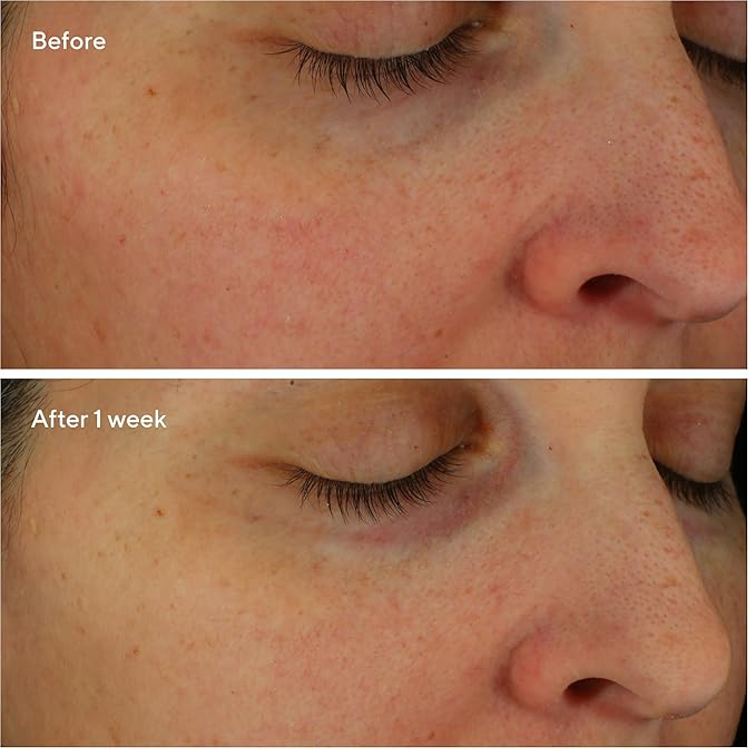 Murad Restorative Hydro-Hyaluronic Moisturizing Face Cream - Hyaluronic Acid Moisturizer for Face with Coconut Extract and Shea Butter Targeting Dry, Dehydrated Skin, 1.7Fl Oz