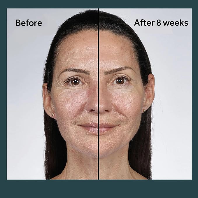 No7 Future Renew Damage Reversal Night Cream - Anti Aging Face Moisturizer - Infused with Peptide Technology to Reverse Visible Signs of Damage - Skin Barrier Repair for Dry Skin (1.69 Oz)