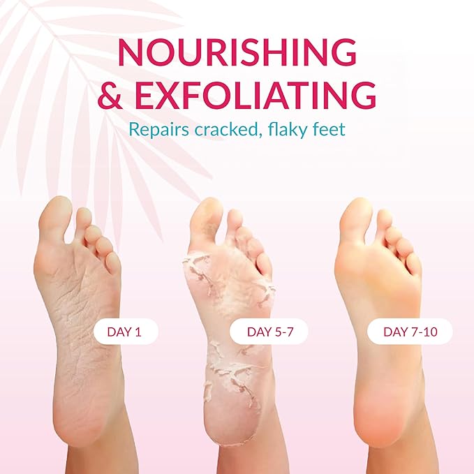 Peeling Mask That Removes Dead Skin - Dermatologically Tested Callus Remover for Dry Cracked Feet - Exfoliating Foot Peel Mask for Baby Soft Feet - 2 Pack with Cucumber & Urea Extracts