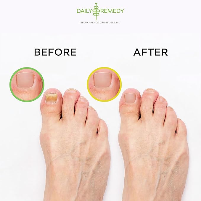 DAILY REMEDY Tea Tree Oil & Citrus Foot Soak Set, Pack of 2, for Foot Pain, Odor, Sore Feet, Athlete’s Foot, Soften Calluses - Natural Blend & Salts, Made In USA