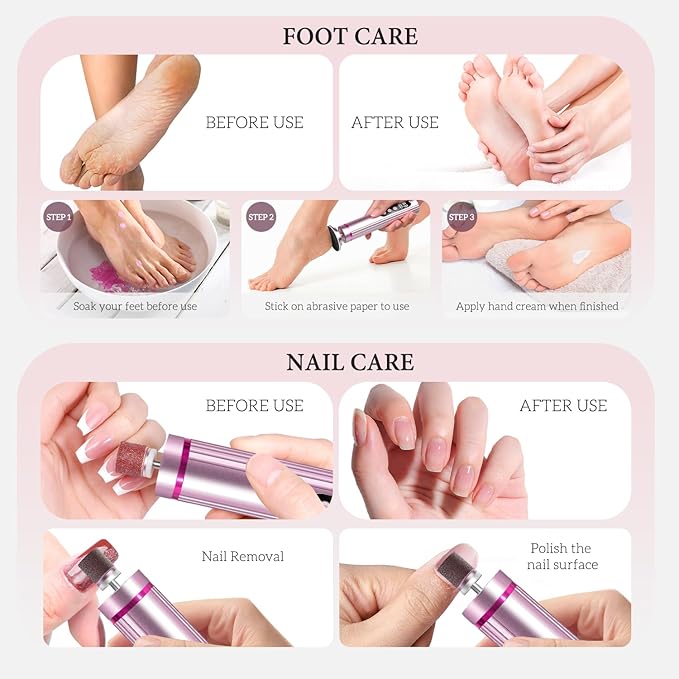 Ranrose Electric Foot File Callus Remover - Professional Cordless Foot Sander for Cracked Heels & Dead Skin, 9-Speed Pedicure Tool with LED Display & Fast Charging Gift-Ready for Women