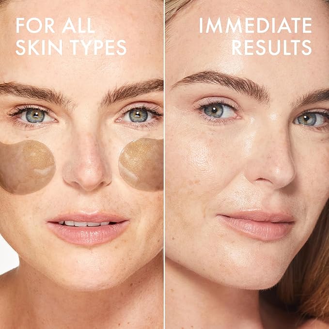 depology Black Caviar Under Eye Patch (30 Pairs) | Hydrogel Eye Patches | Aimed at Smoothing the Look of Fine Lines and Wrinkles | Hydrating Skincare with Hyaluronic Acid & CICA