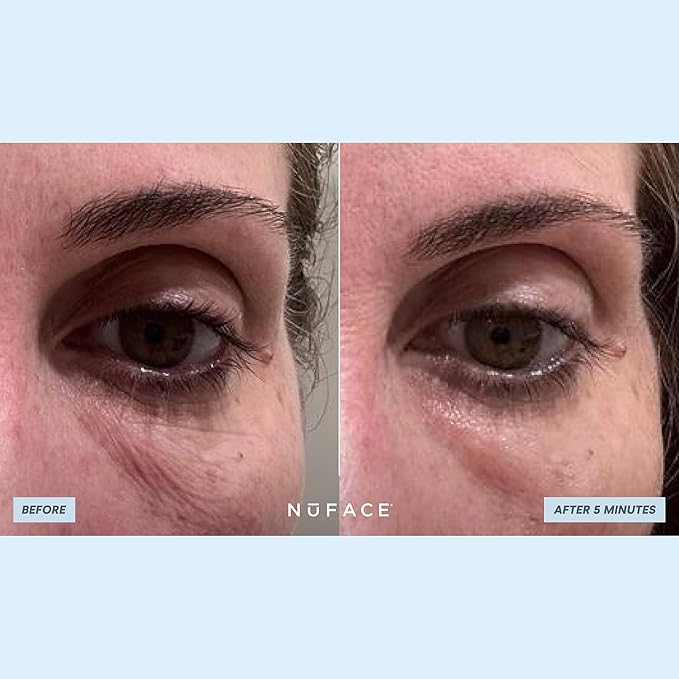 NuFACE IonPlex Hydra-Gel Power Under Eye Patches - Gel Under Eye Mask for Puffy Eyes & Dark Circles - Cooling Wrinkle Patches & Hydrating Treatment Pads to Energize, Brighten & Tighten (60 Count)