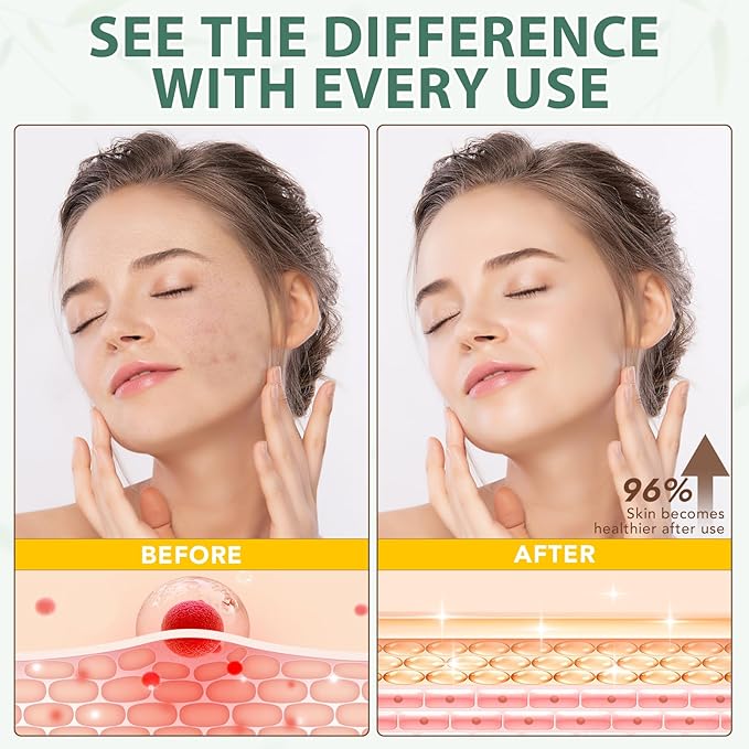 Beef Tallow for Skin, Tallow Face Moisturizer, 4.2 oz Organic Whipped Grass Fed Beef Tallow with Honey Cream for Face & Body, Unscented