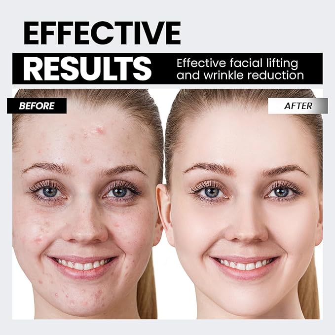 Microcurrent Facial Device,Latest Red Light Technology,Enhances The Ability to Lift The Face and Tighten The Skin,Facial Wrinkle Equipment,Smart Photon Micro-Current Device,Model:EP-300. (Black)