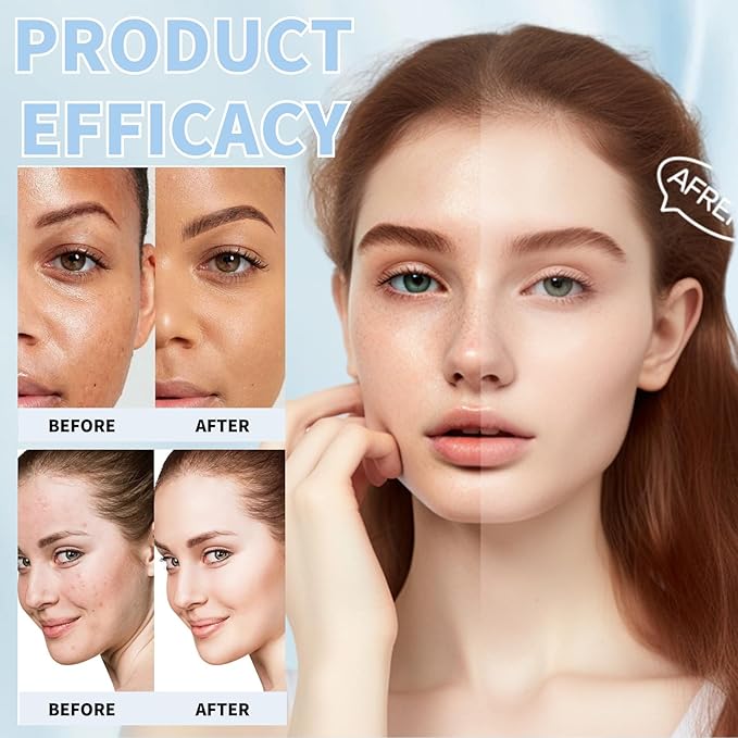 Milk Skincare Sets for Teen Girls - Face Care Kit with Sunscreen, Serum, Toner, Eye Cream - Moisturizing & Firming - Unisex - Skin Care Set