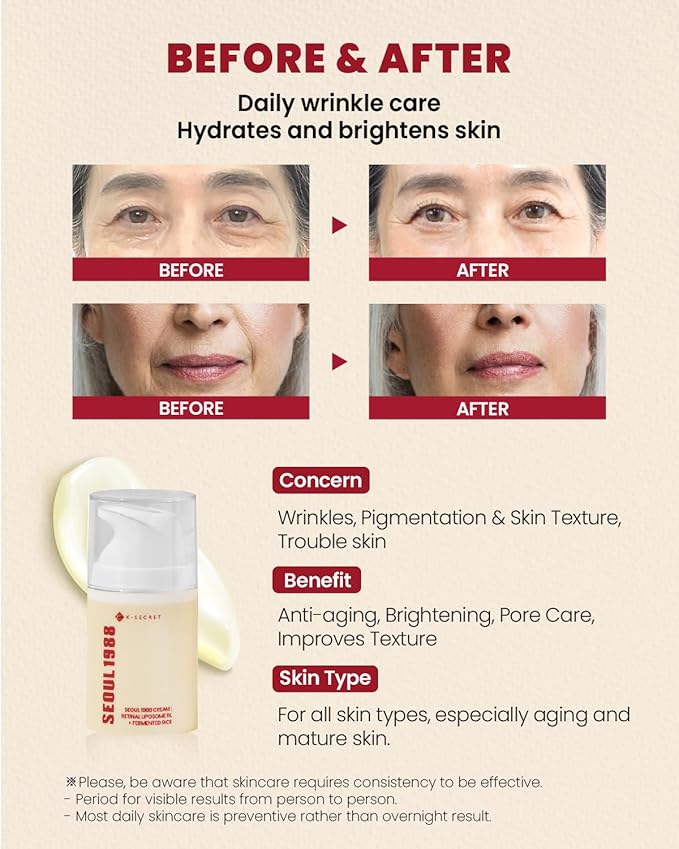 KSECRET SEOUL 1988 Cream : Retinal Liposome 1% + Fermented Rice, 50ml/1.69fl.oz.