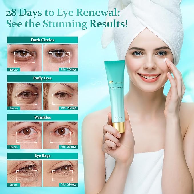 Retinol Under Eye Cream - Anti Aging Eye Cream for Eye Bags, Dark Circles, and Fade Wrinkles, Fine Lines Skin Care Treatment for Women and Men, (1 Fl Oz)