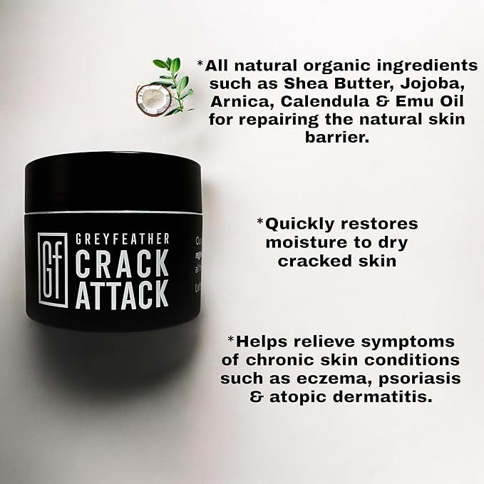 Greyfeather Crack Attack Hand Cream for Dry Cracked Hands & Feet, Skin Repair Cream for Gardeners, Nurses, Bug Bites, Rashes, Gift for Father's & Mother’s Day, Weddings, Outdoor Use (4 oz)