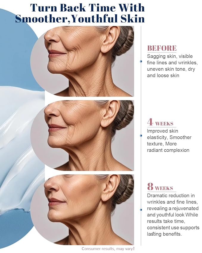 Retinol Cream for Face, Face Moisturizer, Neck Creams for Tightening and Firming with Collagen & Hyaluronic Acid, Daily Anti-Aging Face Cream for Women, Smooth Wrinkles & Fine Lines, 1.7 Fl Oz