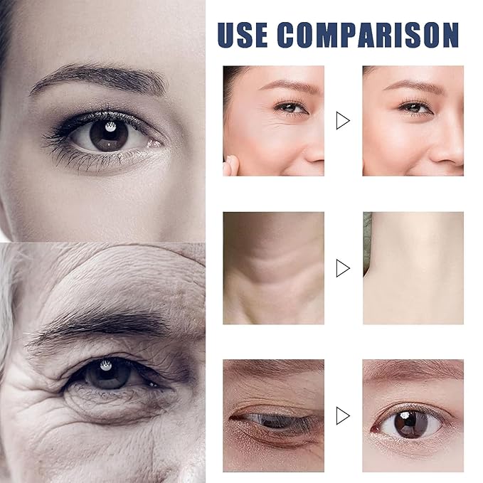 Qingling Crema Para Arrugas, Qingling Face Cream, Qingling Wrinkle Removal Cream, Polypeptide Tightening and Anti Wrinkle Cream, Anti Aging Moisturizer for Firming Face (2pcs)