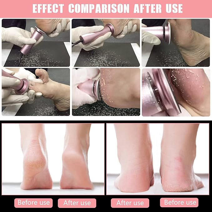 Electric Foot Callus Remover Speed Adjustable with 60pcs Replacement Sandpaper Discs Pedicure Tool Kit Callus Shaver Dead Cracked Hard Dry Skin Nail Clipper Set 16 in 1 (Black)