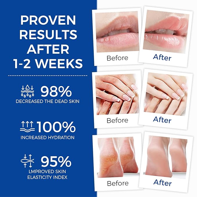 Healing Ointment, Advanced Therapy Skin Protectant, Multi-Purpose Healing Ointment and Body Moisturizer, For Dry, Cracked Skin, Minor Cuts and Burns, Soothes Cracked Hands and Chapped Lips