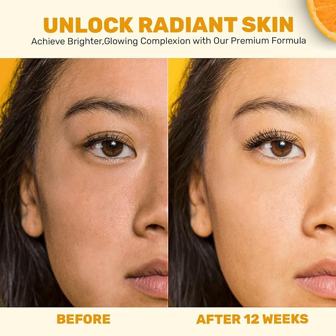 Vitamin C Serum with Citrus Stem Cell, Facial Skin Care Serum for Moisturizing and Brightening with Orange Fruit and Chamomile Extract, Hydrating Serum for Face and Neck, 1 oz