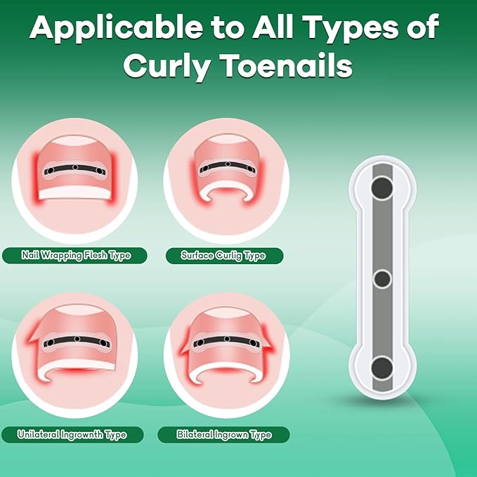 Titanium Alloy Ingrown Toenail Treatment New Version Ingrown Toenail Removal Tool Kit, Designed for Curved Nail Repair Big Toe Ingrown Toenail Corrector