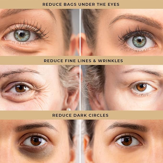 Instant Firm Eye Tightening Cream: Temporary Under Eye Bag Puffiness Removal - Tightener Reducer Treatment for Senior Men and Women, 30mL