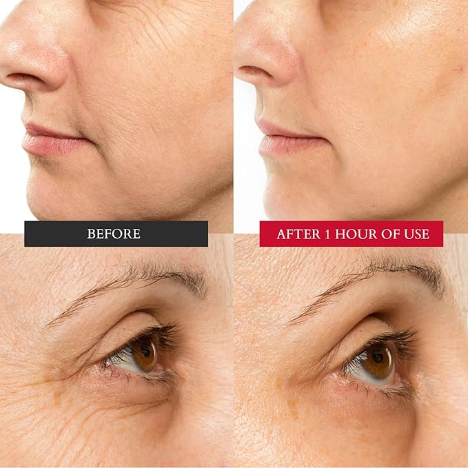 CHUDA Healing Hydrating Cream Skin Care Moisturizer Anti Aging Face Cream - 50ml Made in USA, Daily Face Moisturizer Cream with Remedea Compound, Facial Moisturizers for Dry Skin, Damage and Wrinkles