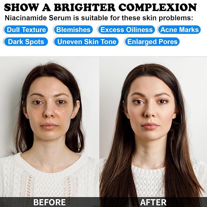 Niacinamide Serum for Face with Zinc & Hyaluronic Acid,Smoothes Wrinkles,Improves Elasticity,Firms Skin 1 Oz for Face Care, Daily Use