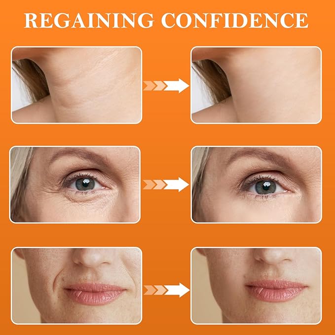 Super Vitamin C Serum for Women Over 70, Vitamin C Serum for Face, 4pack All-In-One Hydrating, with Hyaluronic Acid Vitamin E Smooths Fine Lines for Neck Face,50ML