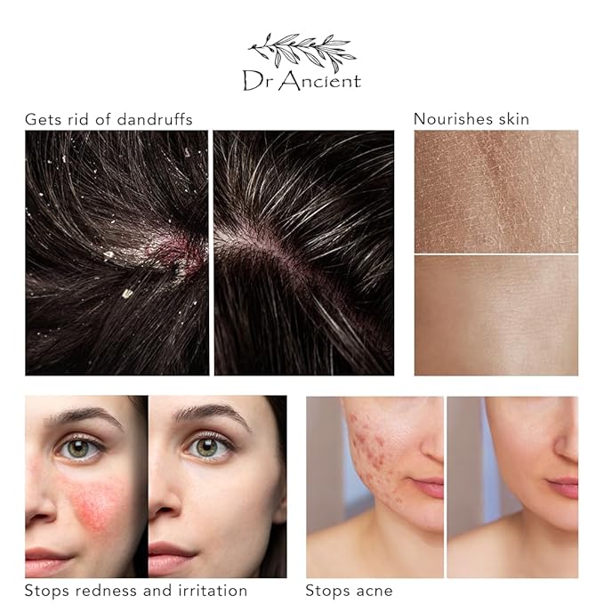 Olive Oil Soap Bar Organic Natural Vegan Traditional Handmade Antique - Antibacterial, Effective For Acne - Absolutely No Chemicals! Pure Natural Soap!