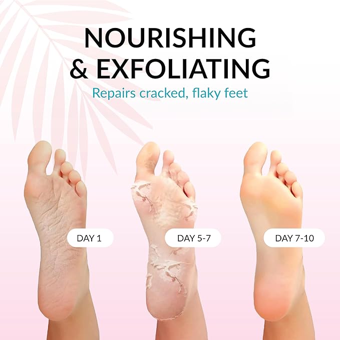 Foot Peeling Mask (1 Pair for Men) - Dermatologically Tested in Germany - Exfoliating Foot Peel Mask for Soft Feet with Natural Extracts