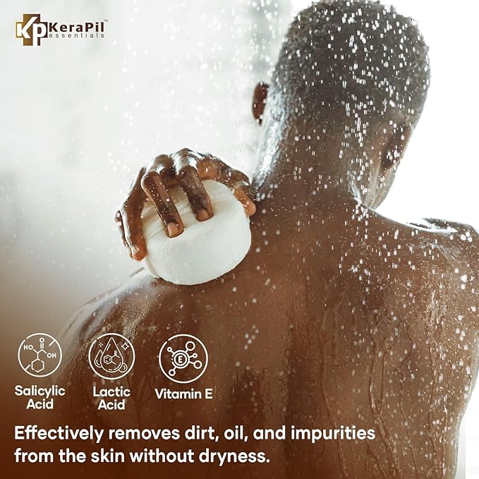 Salicylic Acid Body Wash - Exfoliates Rough Skin, Treats Body Acne - Coconut and Vanilla Scent - 16 fl oz