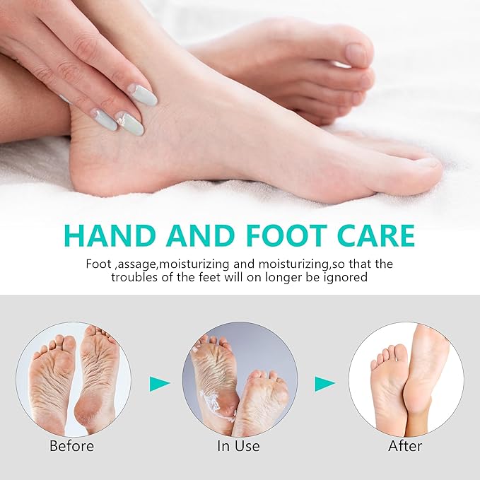 Urea Cream 40 Percent for Feet Maximum Strength, Urea Foot and Hand Cream with Powerful Hydration for Dry Skin, Cracked Heels, Deeply Moisturizing for All Skin Types 7.05oz