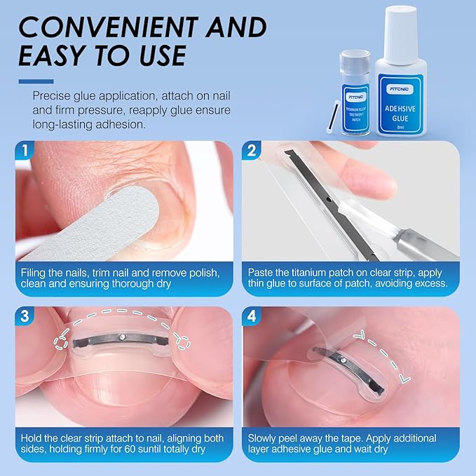 Titanium Alloy Ingrown Toenail Treatment, Ingrown Toenail Removal Kit Specially Designed for Curved Nail Repair and Ingrown Toenail Corrector Kit