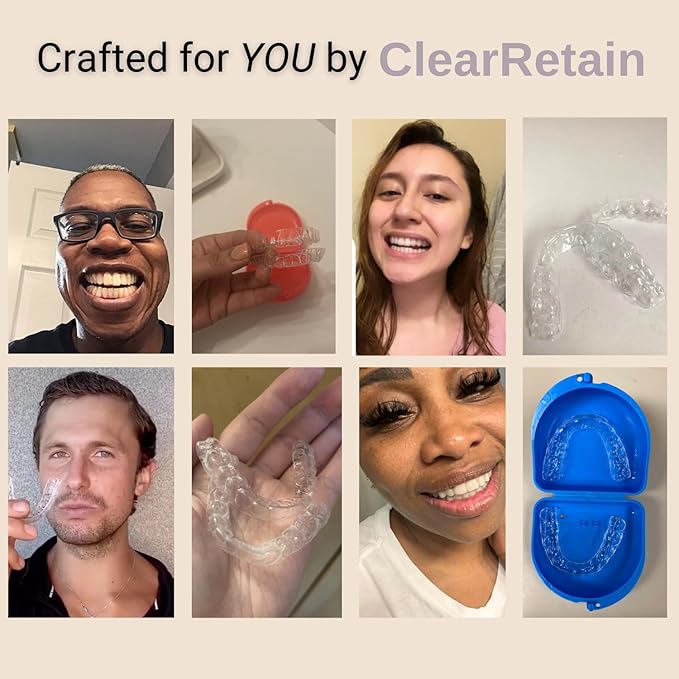 Custom Clear Dental Retainers Retainer | at Home Kit for Perfect Custom Fit Great for Replacement Retainers (Upper Only)