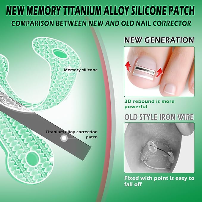 Titanium Alloy Silicone Ingrown Correction Tool Kit,Ingrown Toenail Treatment,Ingrown Toenail Removal Kit,Designed for Ingrown Nail Repair, nail Corrector, Cuttable Applicable to most sizes,reusable