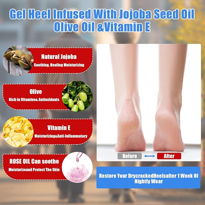 8Pairs Moisturizing Gel Heel Socks, Silicone Heel Socks, Heel Socks for Dry Cracked Feet Women, Toeless Heel Repair Socks for Foot Care Treatment, Cracked Heels, Dry Feet, Foot Calluses