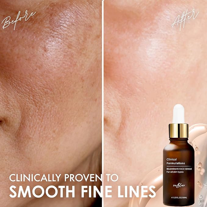 Rejuvenate Resurfacing Face Serum - Skin Care Serum for Face Wrinkles, Fine Lines, Dark Spots - Multi-Weight Hyaluronic Acid Formula for All Skin Types - 1 fl.oz.