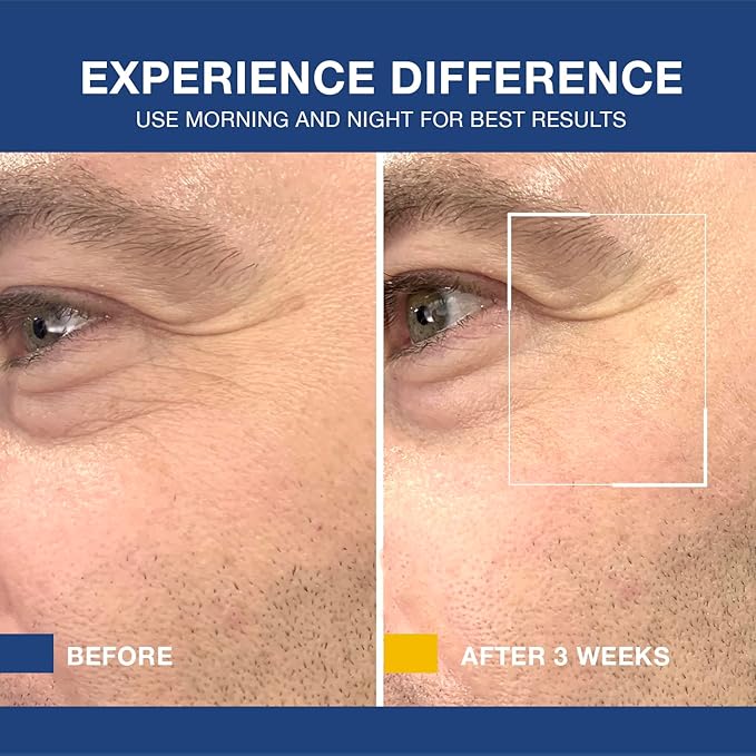 6 in 1 Mens Face Moisturizer: Face Cream for Men - Mens Face Moisturizer-Eye Bags Treatment & Face Lotion for Men, Mens Anti Aging Cream, Wrinkles Cream, After Shave Lotion for Men (1.7oz Pack of 2)