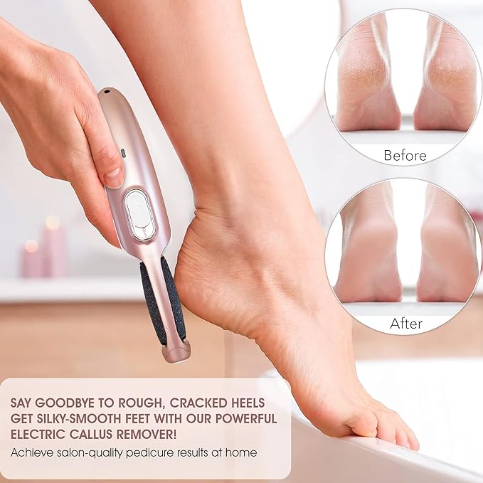 Powerful Electric Callus Remover Wand – Rechargeable Foot File, Grinder & Scrubber - Removes Dry, Dead, Hard Skin & Calluses – Best Pedicure Tool for Soft, Smooth Feet for Men & Women