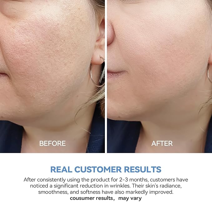 Ultra Hydrating Serum 3% 4D Hyaluronic Acid Smoother Skin|Pre-makeup SkinCare|Anti-Aging serum for face Single-Use Vials Skincare for Dry&Sensitive skin(1.2 ml)*30