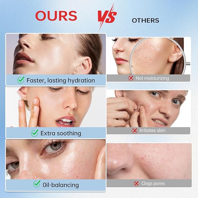 VGO Snail Mucin 92% Face Moisturizer – Anti Aging, Skin Repair & Hydrating Face Cream with Ceramide & Vitamin E, 1.76 oz