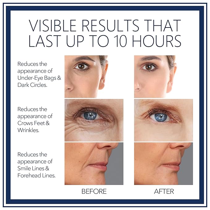 Rapid Reduction Eye Serum - Visibly Reduces Under-Eye Bags, Wrinkles, Dark Circles, Fine Lines & Crow's Feet Instantly, Anti Aging Wrinkle Remover for Face-10ML