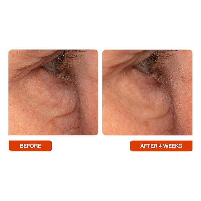 BeautyStat C Eye Perfector Dark Circle Reducing Vitamin C Eye Cream, Made in the USA with 5% L-Ascorbic Acid (Pure Vit C), Hyaluronic Acid - Hydrating, Firming Under Eye Brightener (0.5oz / 15ml)