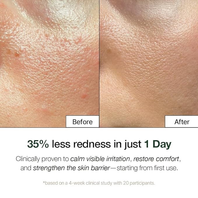 NDP Cica Cream - Gel Face Moisturizer for Sunburn Relief, lightweight Korean Moisturizer for Sensitive Skin, Centella Asiatica, Hydrating, Calming, Soothing (1.7 Fl oz / 50ml)