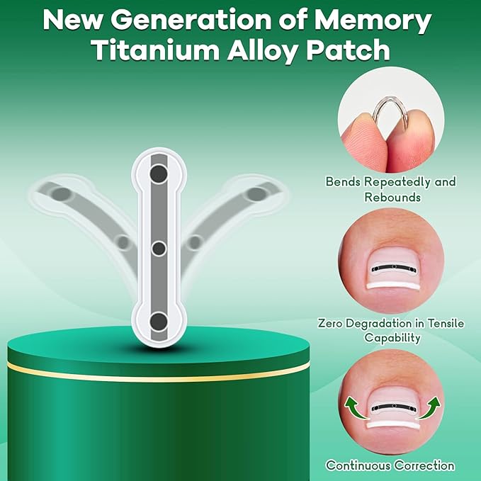 Titanium Alloy Ingrown Toenail Treatment New Version Ingrown Toenail Removal Tool Kit, Designed for Curved Nail Repair Big Toe Ingrown Toenail Corrector