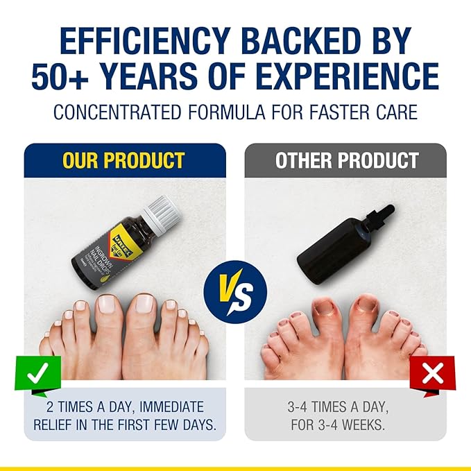 URIEL UPGRADED Ingrown Toenail Treatment, Ingrown Toenail Removal Kit, Ingrown Toenail Corrector, Ingrown Nail Kit Ingrown Toenail Tool 20ml