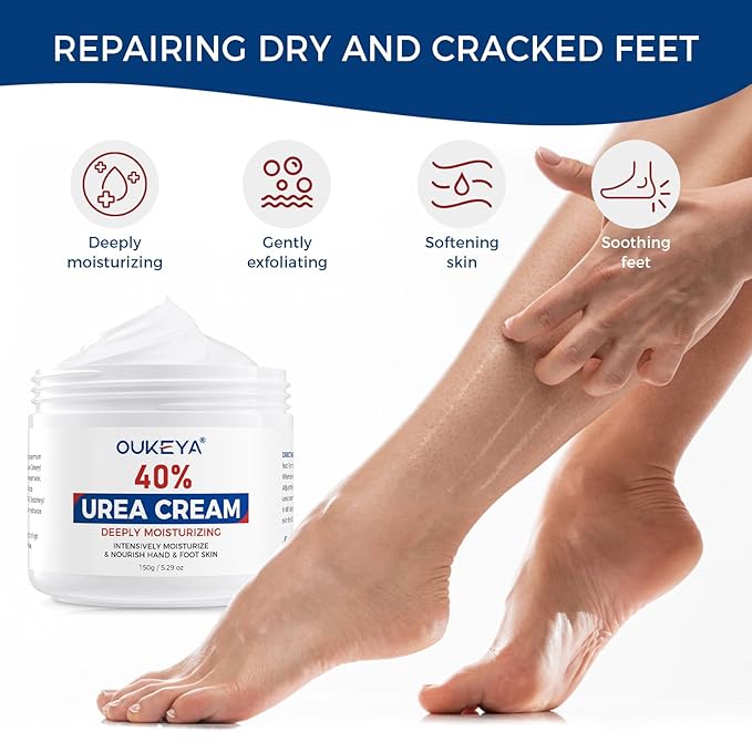 NEW FORMULA Urea Cream 40 Percent for Feet Maximum Strength, Hand Heels Dry Cracked Treatment Lotion for Knees & Elbows, Foot Dead Skin Cuticle Callus Remover Toenail Softener, 5.29 oz