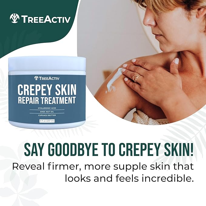 TreeActiv Crepey Skin Repair Treatment Original Formula, 8 fl oz, Firming Cream For Face & Neck, Skin Firming Lotion with Hyaluronic Acid, Crepey Treatment to Address Dry Crepe