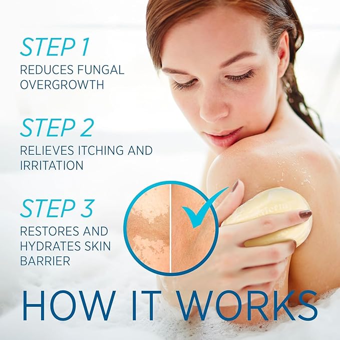 Roycederm Tinea Versicolor Relief Soap: Tea Tree Oil & Sulfur Cleansing Bar, Soothes Irritation, Hydrates & Supports Skin Health