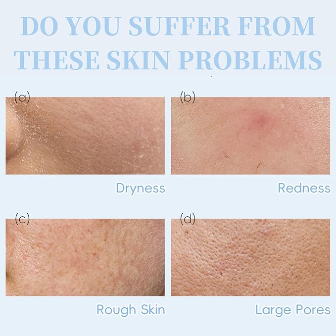 Milk Skincare Sets for Teen Girls - Face Care Kit with Sunscreen, Serum, Toner, Eye Cream - Moisturizing & Firming - Unisex - Skin Care Set