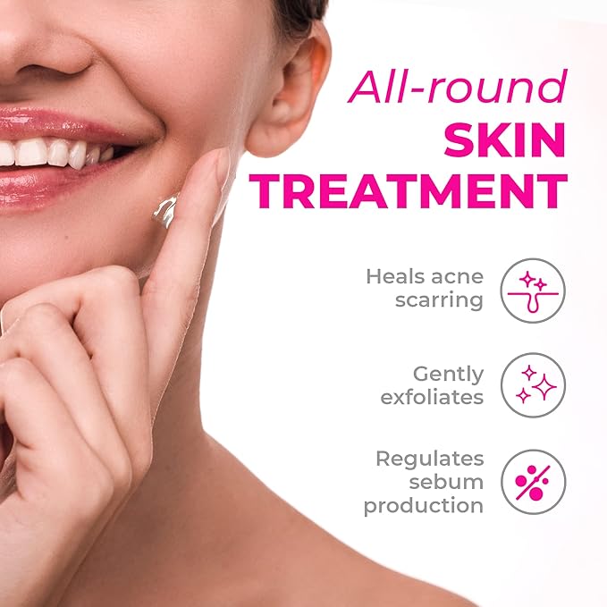 Creamy Skincare Blemish Control 7% Mandelic Gel, Acne and Dark Spot Remover for Face, Soothing Skin Care with Mandelic Acid, Alpha-Arbutin, Allantoin, and Hypskin, Gentle Formula 1 fl oz/30mL