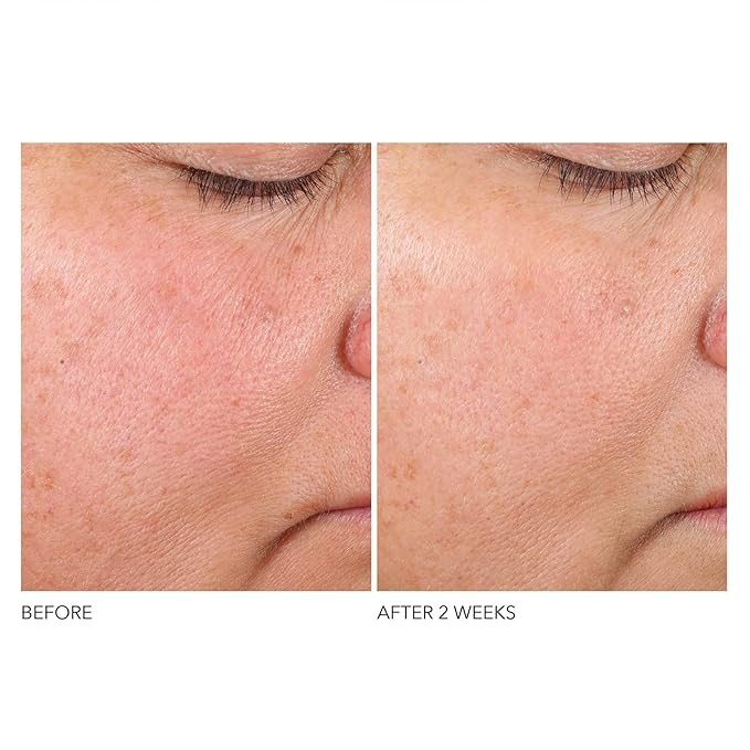 Dr. Dennis Gross Advanced Retinol + Ferulic Serum – Anti-Aging Formula to Smooth Texture, Boost Radiance, and Minimize Fine Lines & Wrinkles, 1 oz