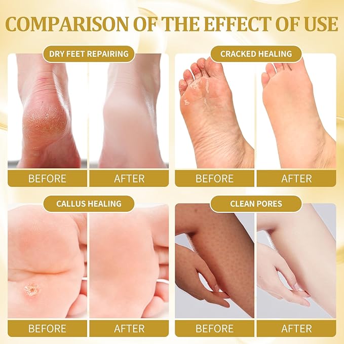 Pedicure Kit Foot Soak Set: Bubble Salt, Sugar Scrub, Massage Mask, Massage Lotion in a Box, 4 Step Foot Spa Kit for Dry Feet, Calluses and Tired Feet(1 Set Honey Flower)